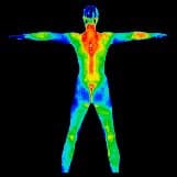 Sample thermogram showing the body's symmetrical thermal patterns